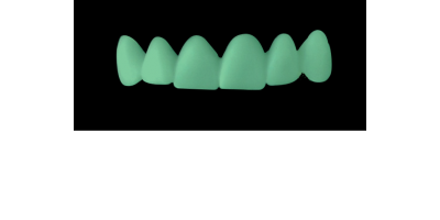 Cod.C4Facing : 10x  wax facings-bridges,  MEDIUM, Triangular, TOOTH 13-23, compatible with Cod.A4Lingual,TOOTH 13-23 for long-term provisionals preparation provisional preparation TOOTH 13-23